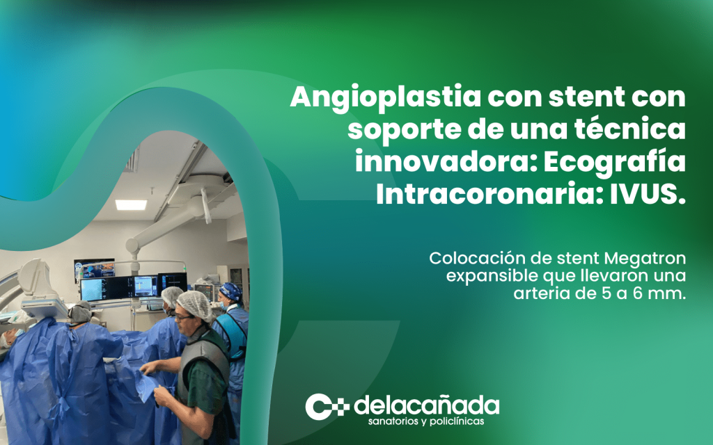 Angioplastia con stent
